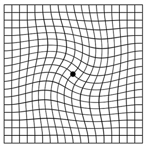 Distorted Amsler Grid as seen with Macular Degeneration